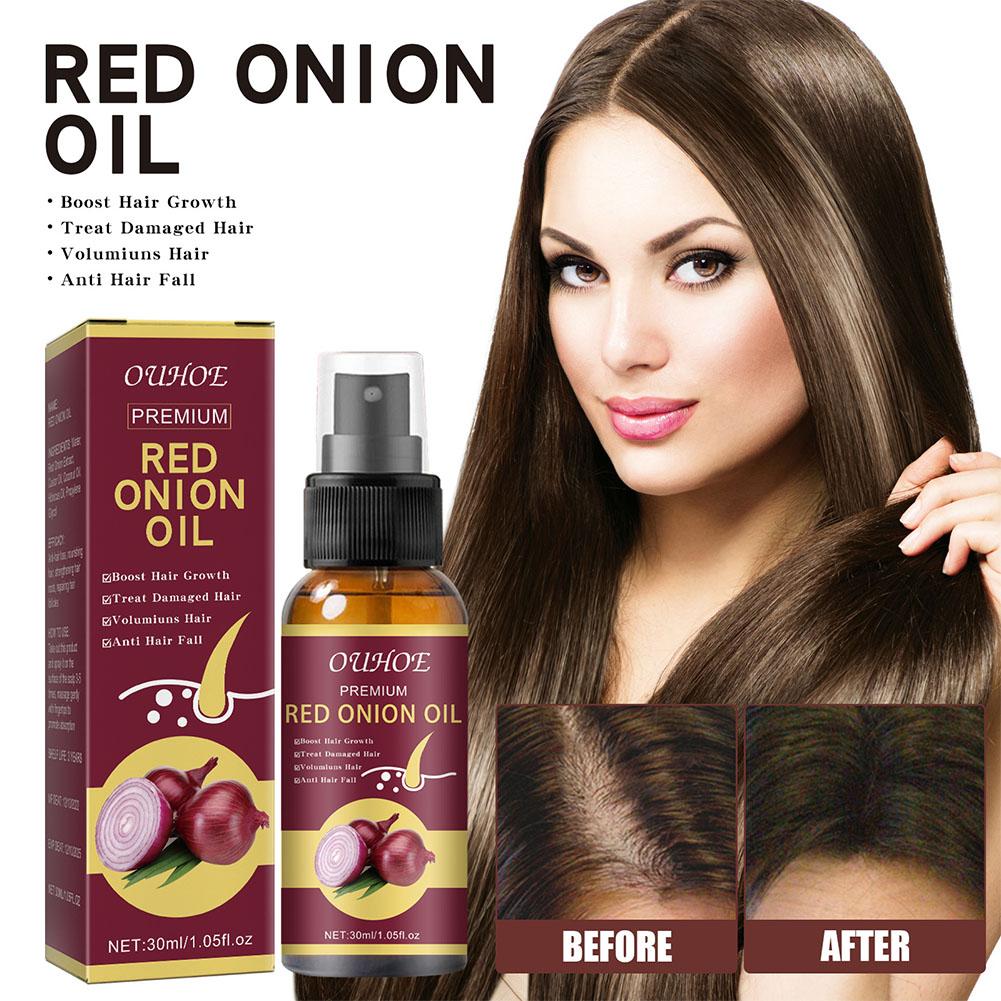 1/3/5PCS Red Onion Essential O - Hair Care With Rice Water reseña y precio