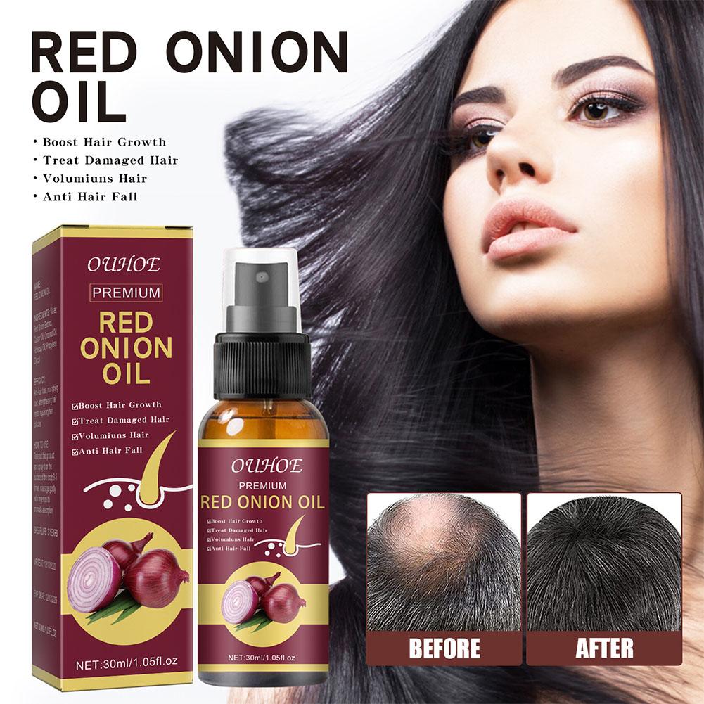 1/3/5PCS Red Onion Essential O - Hair Care With Rice Water reseña y precio