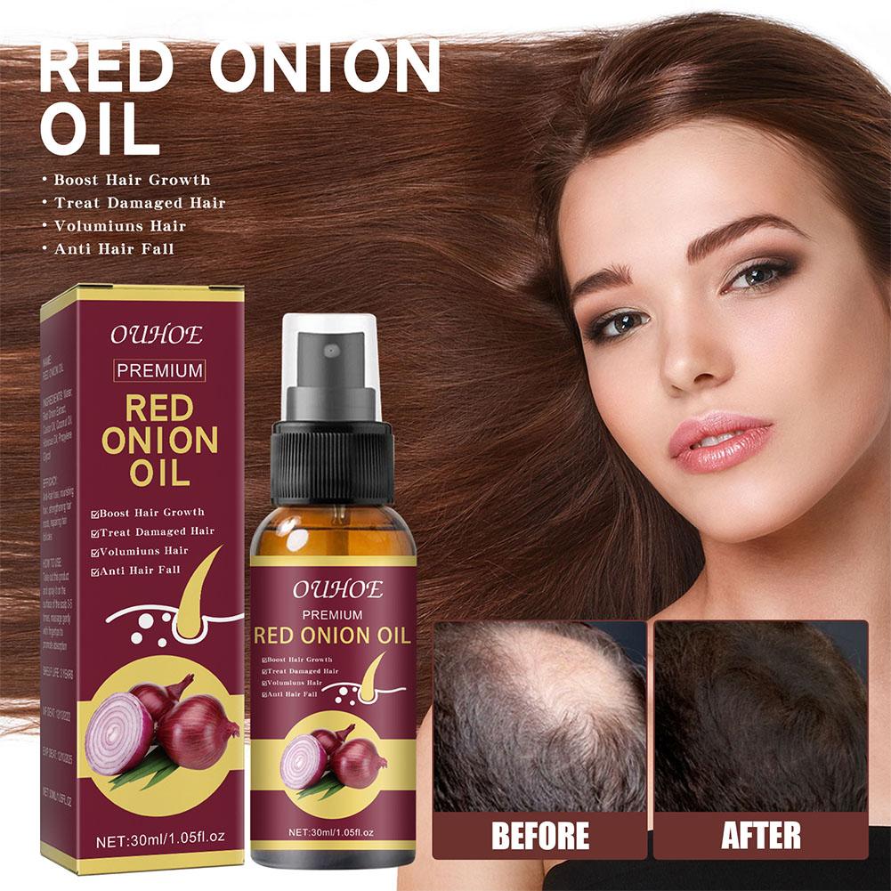 1/3/5PCS Red Onion Essential O - Hair Care With Rice Water reseña y precio