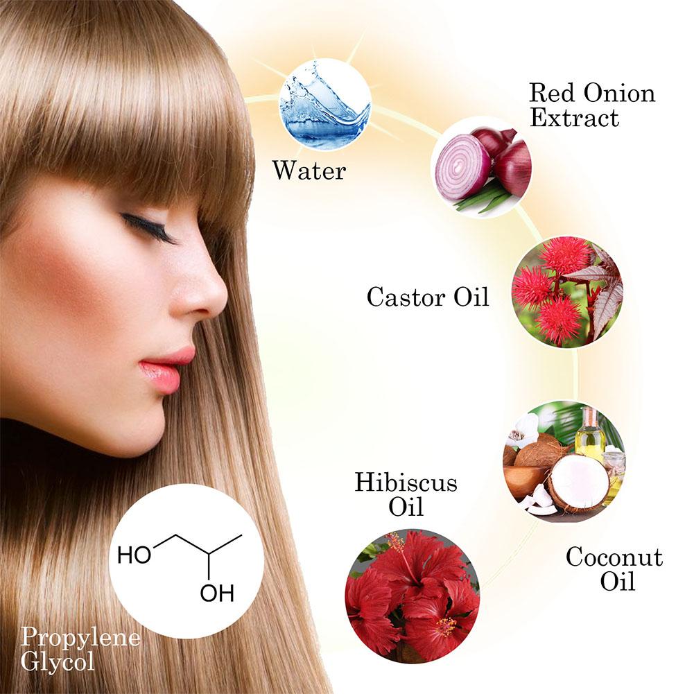 1/3/5PCS Red Onion Essential O - Hair Care With Rice Water reseña y precio