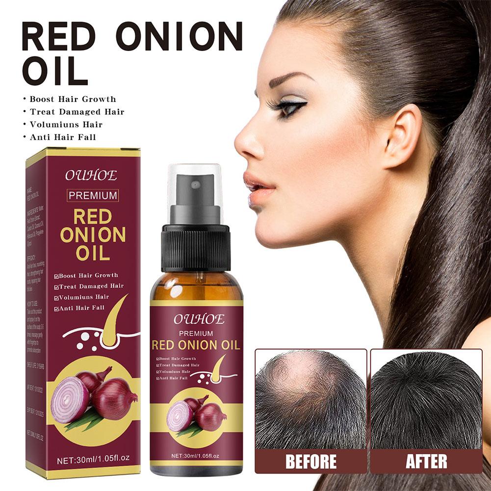 1/2/3pcs Red Onion Essential O - Hair Care With Rice Water reseña y precio