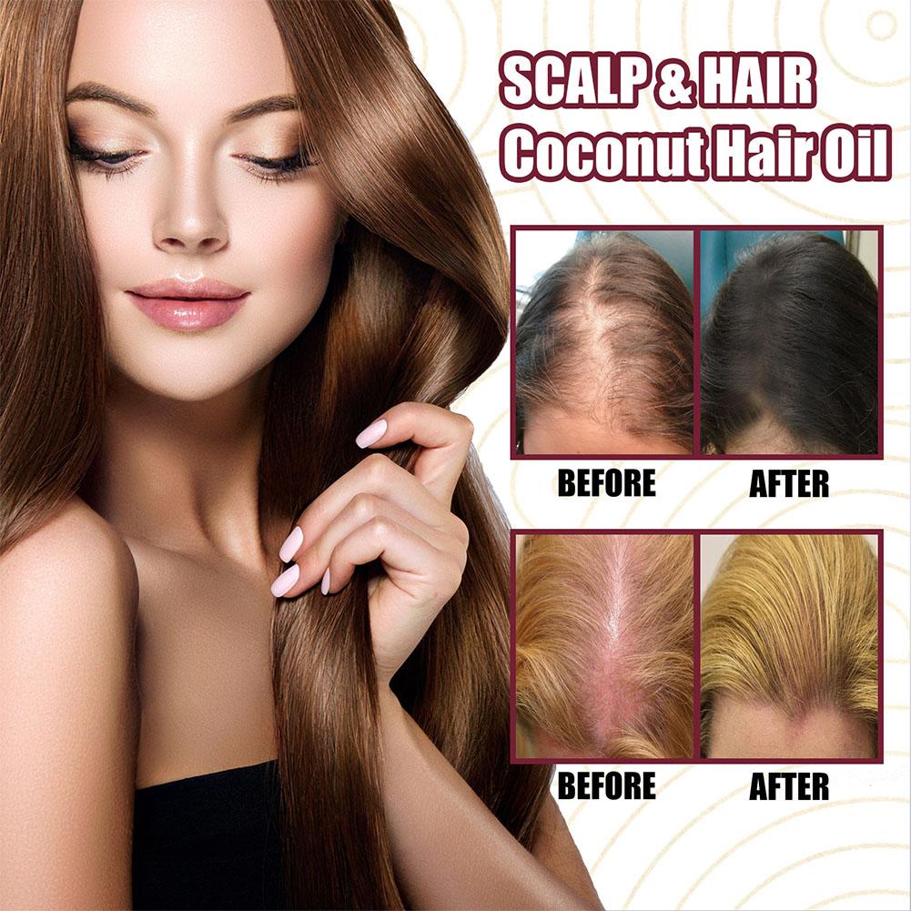 1/2/3pcs Red Onion Essential O - Hair Care With Rice Water reseña y precio