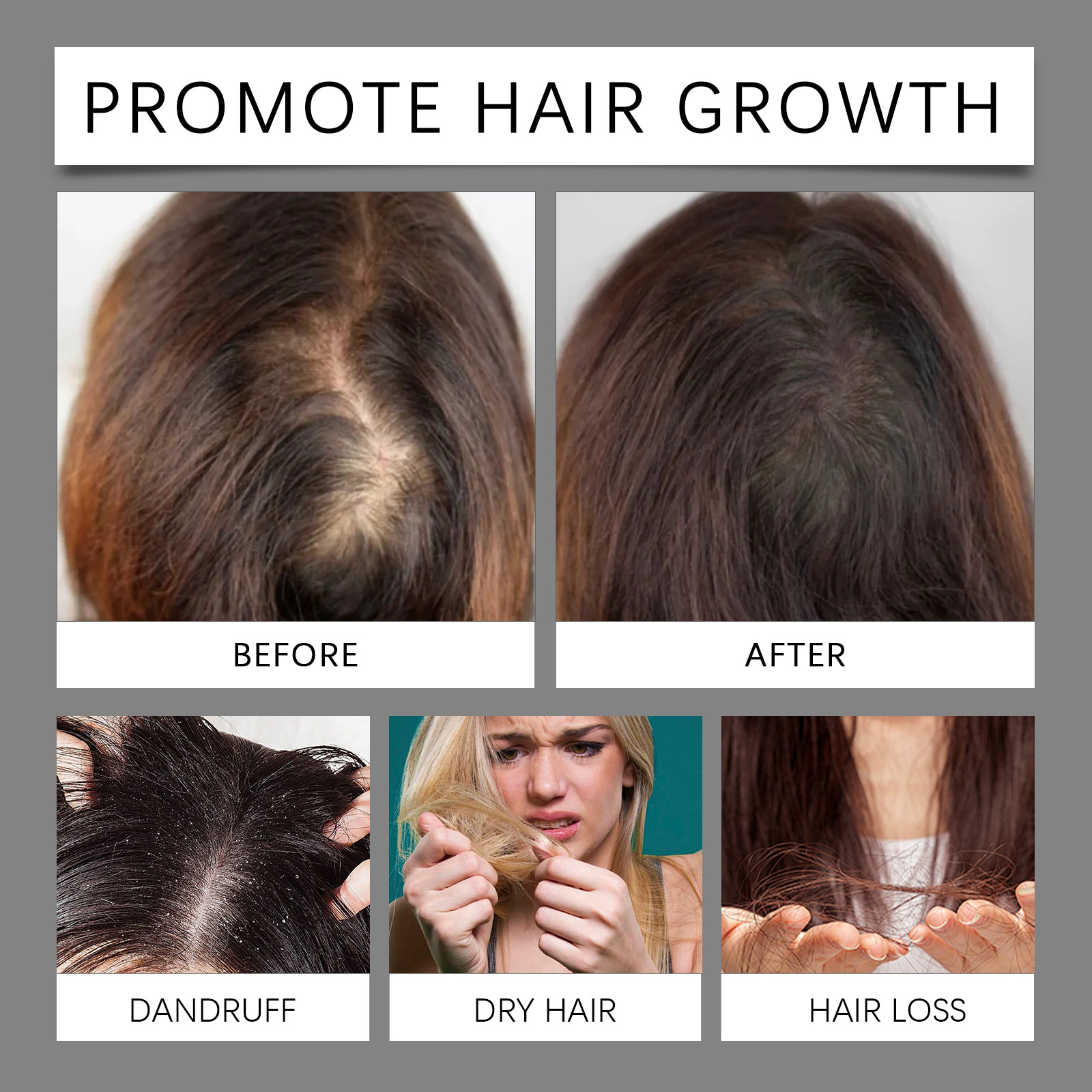 30ml Hair Care Essential Oil T - Hair Care Essence reseña y precio