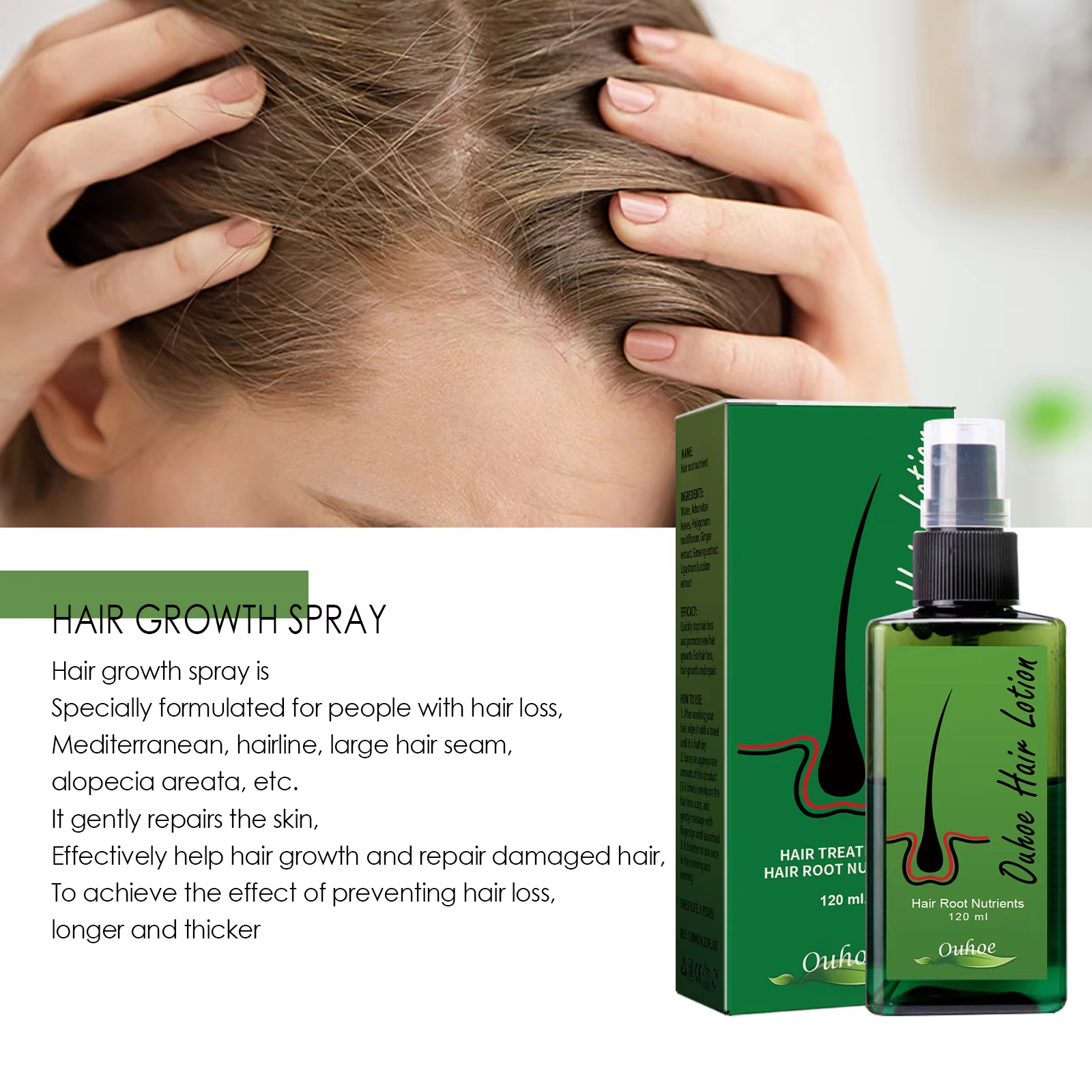 Hair Growth Spray Anti Hair Lo - Hair Care Essence reseña y precio