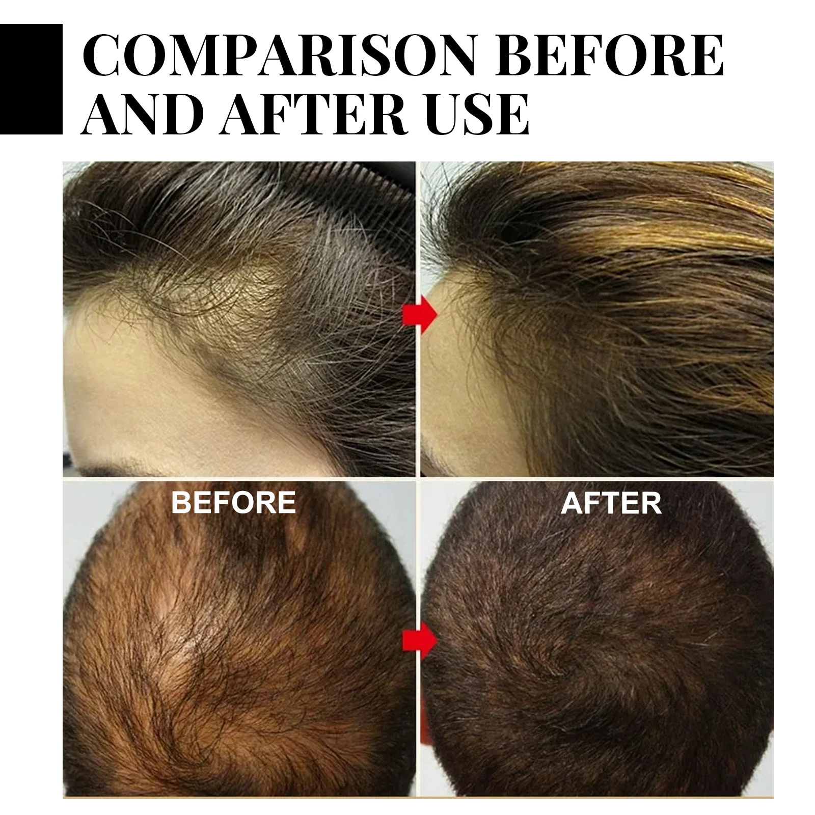 Ginger Hair Growth spray Anti  - Hair Care Essence reseña y precio