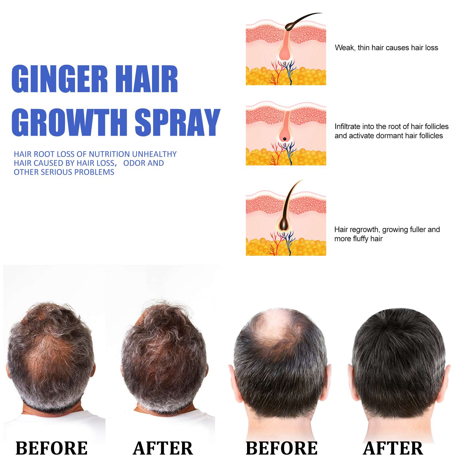 Ginger Hair Growth spray Anti  - Hair Care Essence reseña y precio
